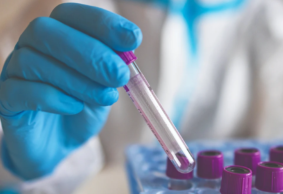 IFU Limitations Matter in Urgent Care Lab Testing